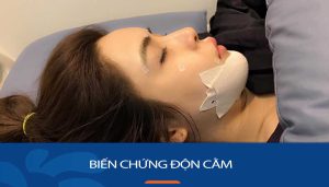 Cứu cánh cho biến chứng độn cằm: Giải pháp khắc phục hiệu quả