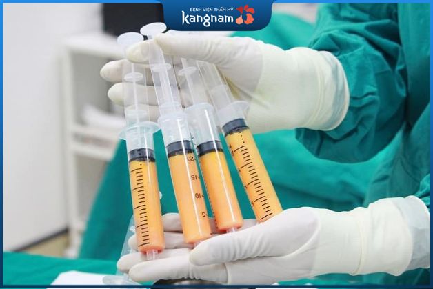 Cấy mỡ nâng ngực tự thân