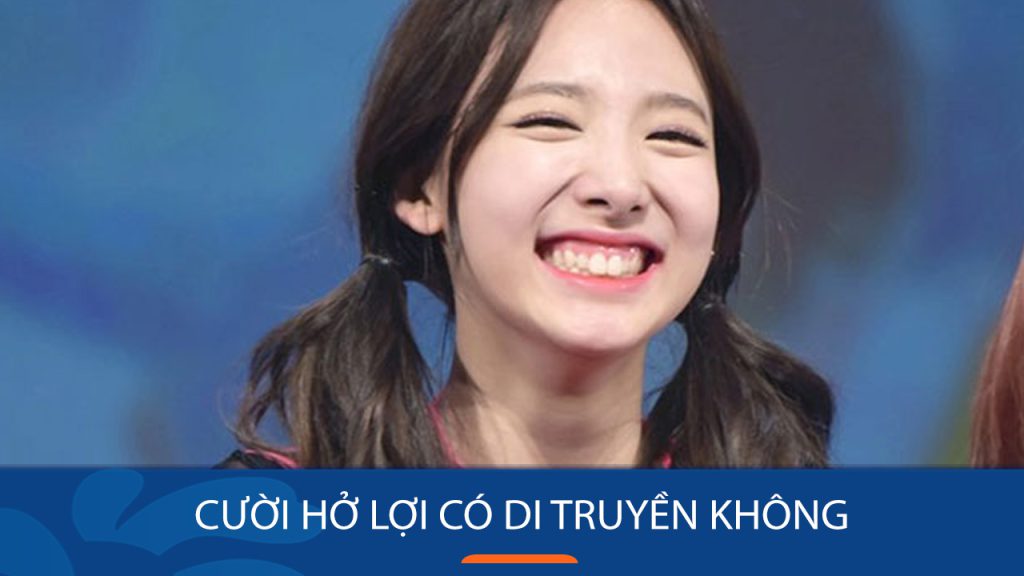 Cười hở lợi có di truyền không? Giải thích từ góc độ y khoa