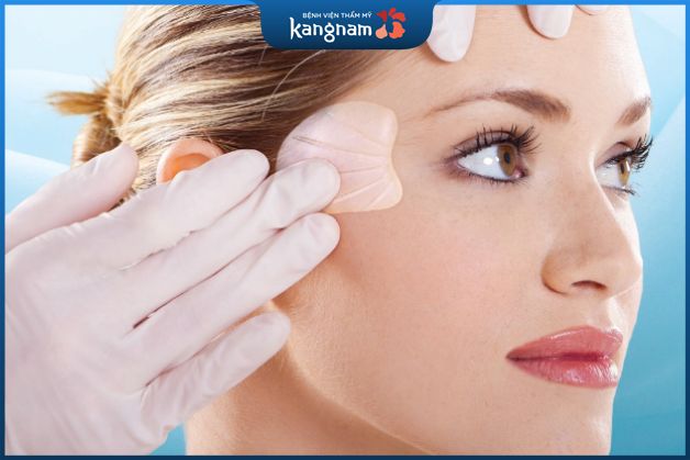 Độn thái dương là phương pháp làm đẹp phổ biến