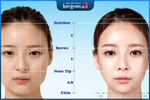 Phẫu thuật gọt hàm