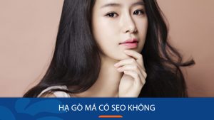 Hạ gò má có sẹo không? 3 Lý do bị sẹo và 5 Cách phòng ngừa