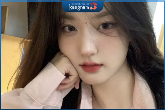 Nốt ruồi nằm ở ấn đường giữa hai chân mày