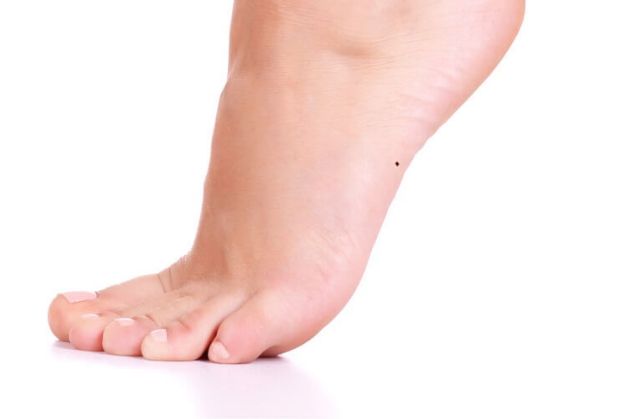 Nốt ruồi ở mép bàn chân trái nữ