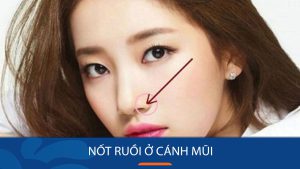 Giải mã bí ẩn nốt ruồi ở cánh mũi: Nam giàu sang, Nữ phú quý?