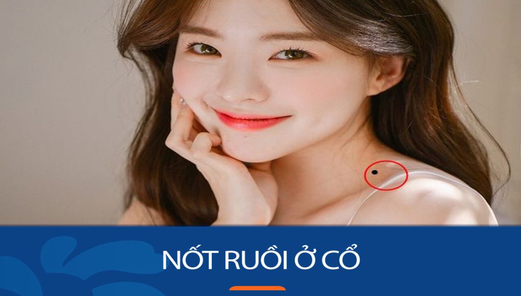 Nốt ruồi trên cổ: Tốt hay xấu? Giải mã bí ẩn vị trí và ý nghĩa