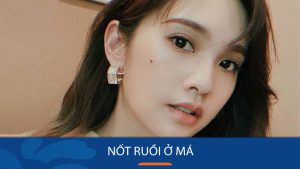 Nốt ruồi may mắn hay nốt ruồi xui xẻo? Giải mã ý nghĩa nốt ruồi ở má Nam, Nữ