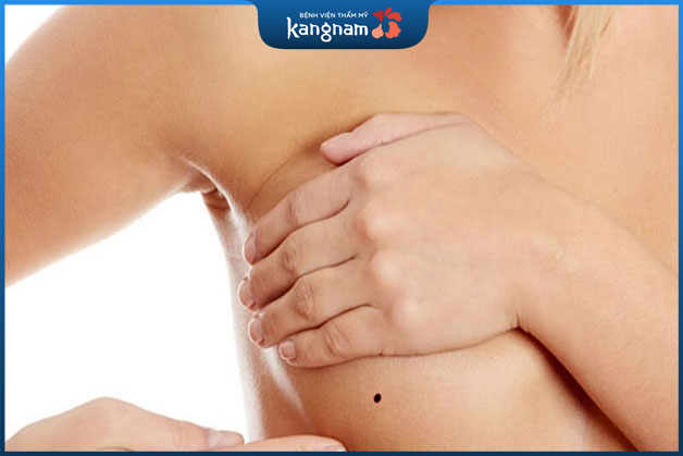 Nếu nốt ruồi xuất hiện ở dưới ngực cho thấy sự nghiệp có nhiều tiến triển 