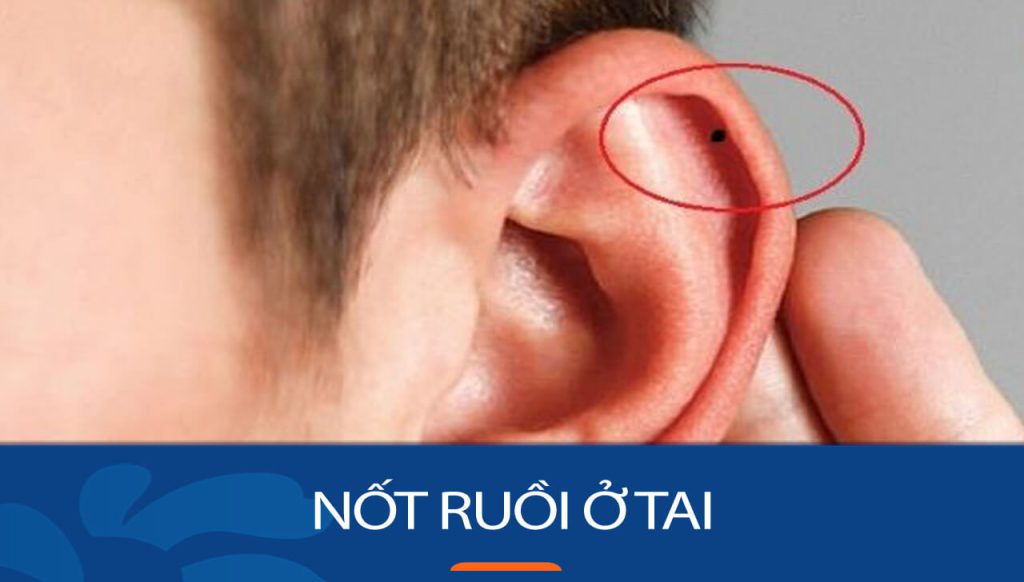 Giải mã bí ẩn nốt ruồi ở tai: Xem tướng vận mệnh, tính cách qua vị trí & kích thước