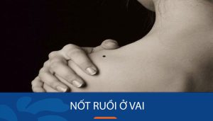 Bật mí bí ẩn nốt ruồi trên vai: Xem tướng số, vận mệnh, tình duyên