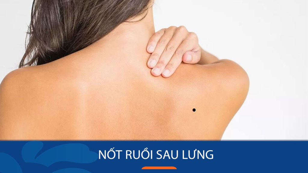 Nốt ruồi sau lưng: Bí ẩn vị trí và lời thì thầm về vận mệnh?