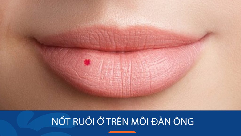Nốt ruồi trên môi: Bí quyết xóa bỏ hoàn toàn, lấy lại vẻ đẹp tự tin