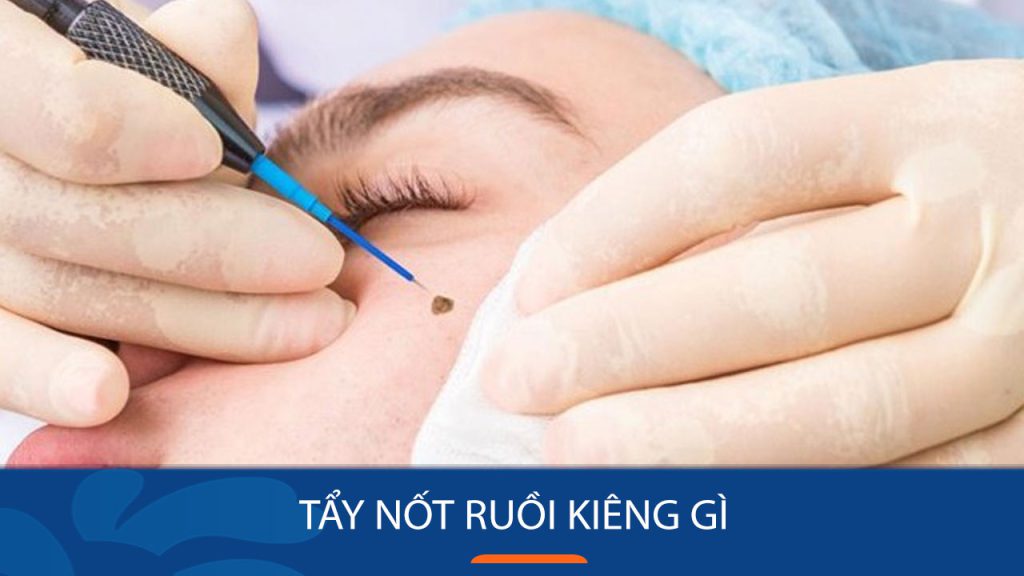 Tẩy nốt ruồi kiêng gì? Bí quyết giúp da mau lành và hạn chế sẹo