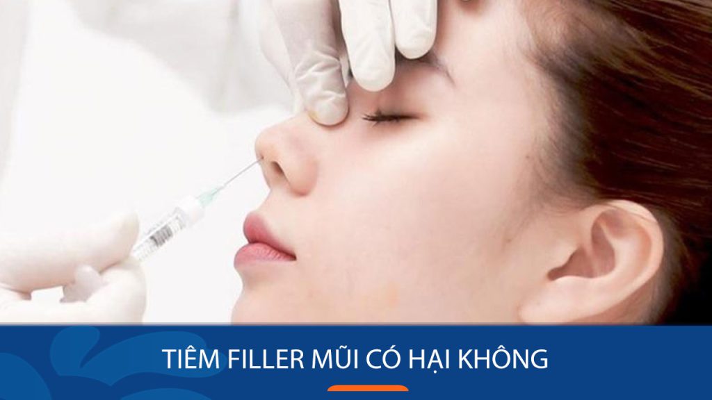 Tiêm filler mũi có hại không? Rủi ro, mức độ an toàn & lưu ý quan trọng