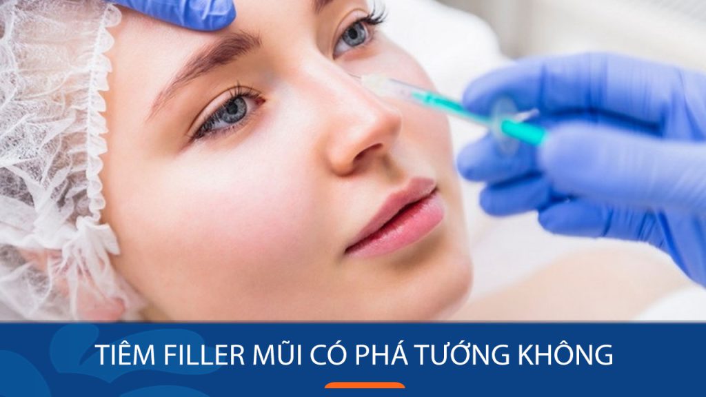 Tiêm filler mũi có phá tướng không? 3 TIPS chỉnh mũi chuẩn đẹp