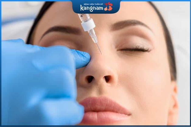 chúng ta hoàn toàn có thể thực hiện nâng mũi sau khi tiêm filler