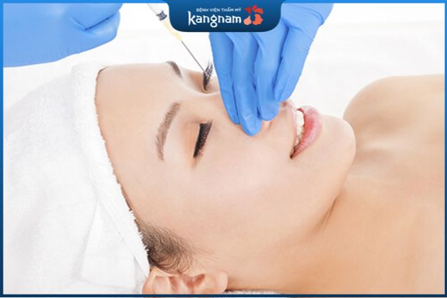 Tiêm tan filler bao lâu thì nâng mũi được