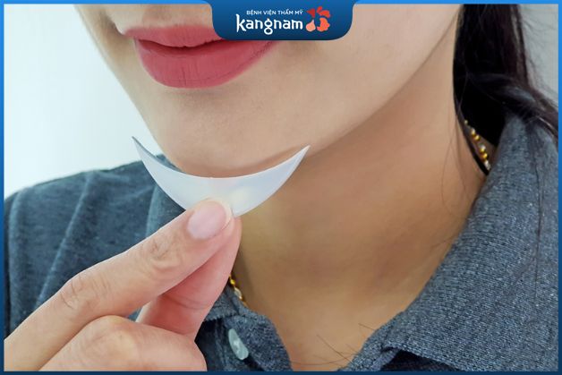 Có nên độn cằm hay không?