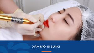 Hướng dẫn cách xử lý khi xăm môi bị sưng