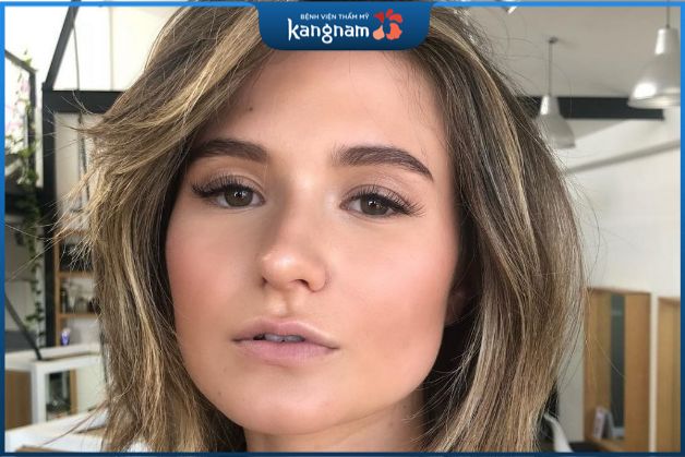 Xương hàm vuông thô