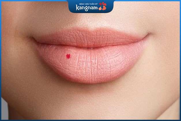 Nữ giới sở hữu nốt ruồi son ở môi vô cùng thu hút người đối diện