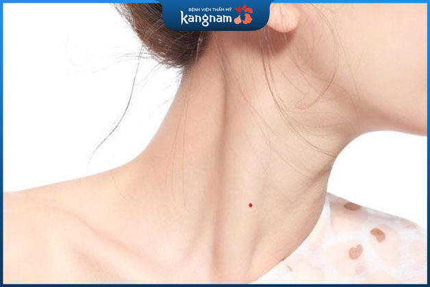 Mụn ruồi son mọc với nhiều dấu hiệu bất thường thì cần phải kiểm tra lập tức