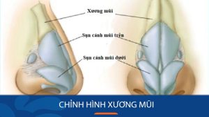 Chỉnh hình xương mũi là gì? Trường hợp cần chỉnh & phương pháp thực hiện