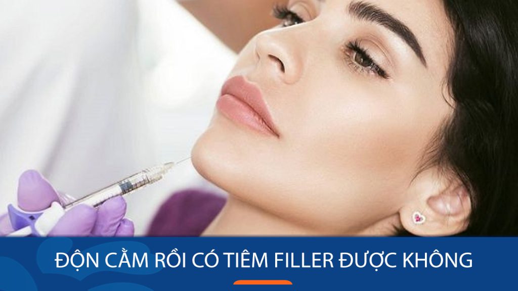 Độn cằm rồi có tiêm filler được không? Trường hợp nên và không nên