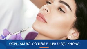 Độn cằm rồi có tiêm filler được không? Trường hợp nên và không nên