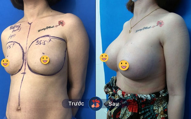 sở hữu bộ ngực tròn đầy nhanh chóng