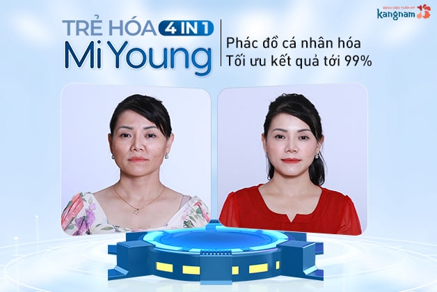 Xóa nhăn, lấp đầy rãnh rồng, trẻ hóa toàn diện