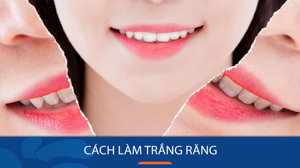 15 Chia sẻ kinh nghiệm: Làm thế nào để có hàm răng trắng sáng