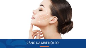 Căng da mặt nội soi: Bí quyết trẻ hóa da hiệu quả nhất