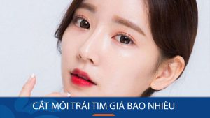 Cắt môi trái tim giá bao nhiêu? Chi tiết bảng giá và ưu đãi mới nhất 2024