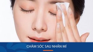 Chăm sóc sau nhấn mí đúng cách: Giảm sưng nhanh, mí mau lành