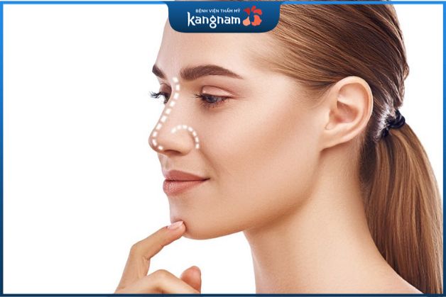 Quyết định phẫu thuật nâng mũi cao tây nên hay không