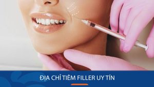 Tiêm filler an toàn, hiệu quả tại TP. Hồ Chí Minh – Xem ngay danh sách địa chỉ uy tín!