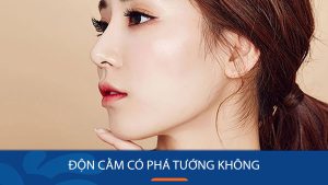 Độn cằm có phá tướng không? Giải đáp từ góc nhìn nhân tướng & thẩm mỹ