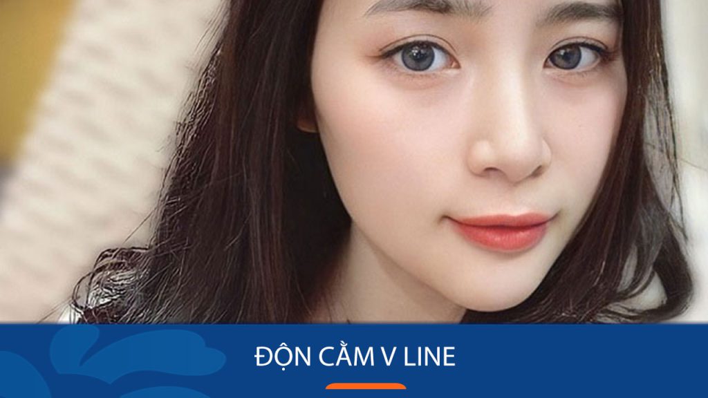 Độn cằm là gì? Các phương pháp độn cằm, chi phí và lưu ý an toàn