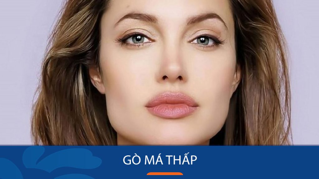 Gò má thấp là gì? Nguyên nhân, ảnh hưởng và cách cải thiện hiệu quả