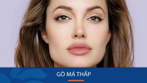 Gò má thấp là gì? Nguyên nhân, ảnh hưởng và cách cải thiện hiệu quả