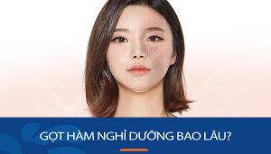 Gọt hàm nghỉ dưỡng bao lâu? Thời gian hồi phục theo từng giai đoạn