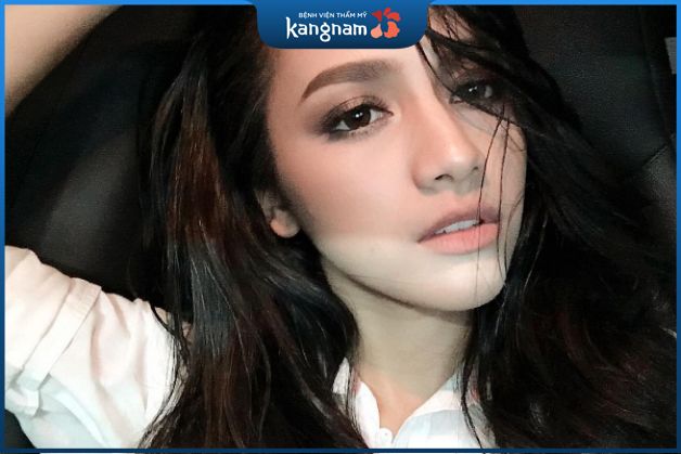 Nâng mũi dáng cao tây