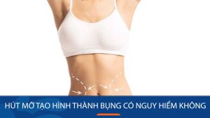 Hút mỡ tạo hình thành bụng có nguy hiểm không – Những điều cần lưu ý