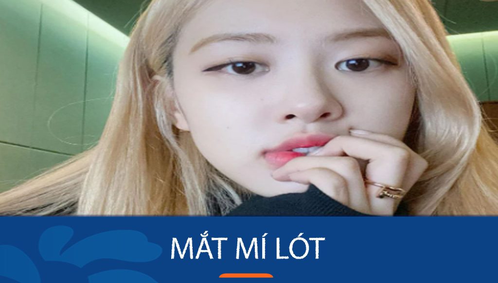 Mắt mí lót là gì? Đặc điểm nhận biết & cách cải thiện phù hợp