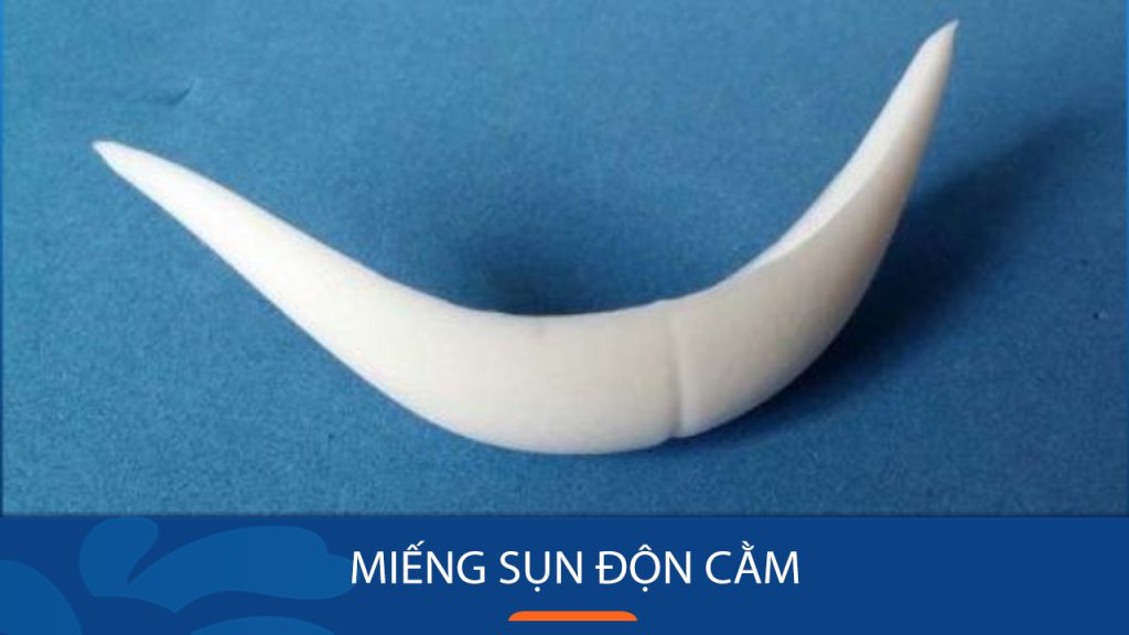 2 Loại sụn độn cằm phổ biến: So sánh ưu/nhược điểm để lựa chọn tốt nhất