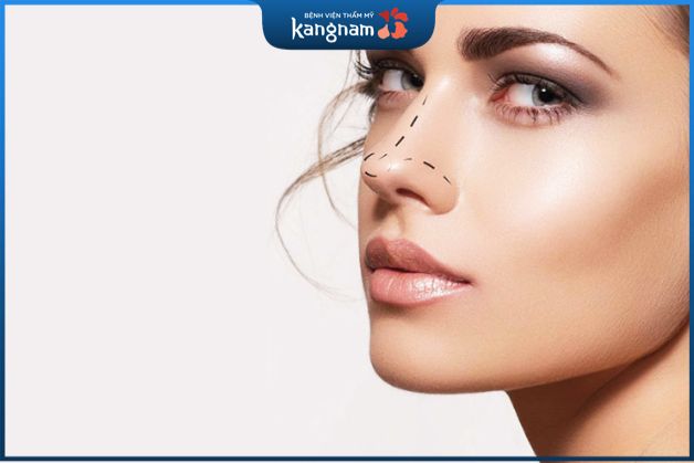 Mũi cao tây thường hợp với những người có gương mặt trái xoan