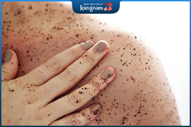 Tẩy da chết body để ngăn ngừa mổi mụn ở ngực