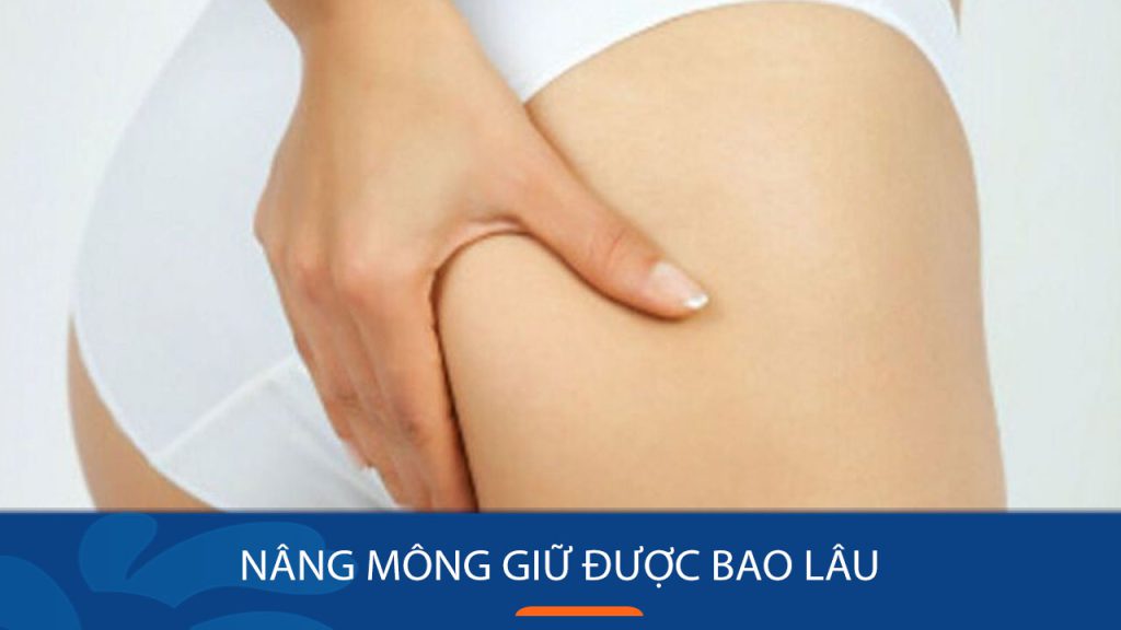 Nâng mông giữ được bao lâu? Có được vĩnh viễn không?