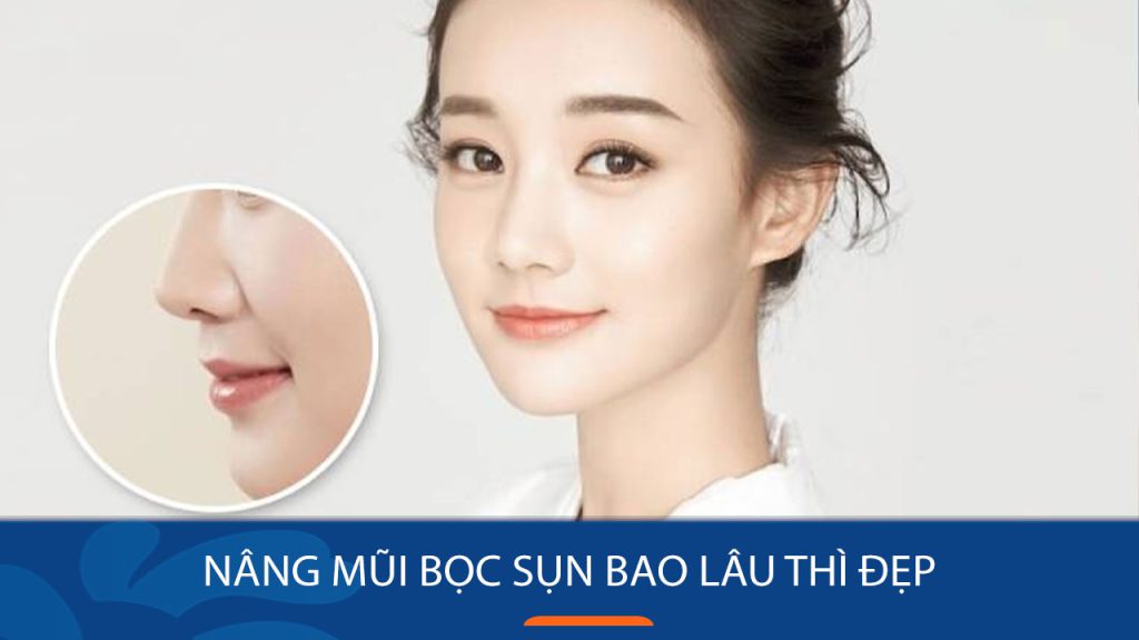Nâng mũi bọc sụn bao lâu thì đẹp? Thời gian hồi phục và cách mũi vào form nhanh